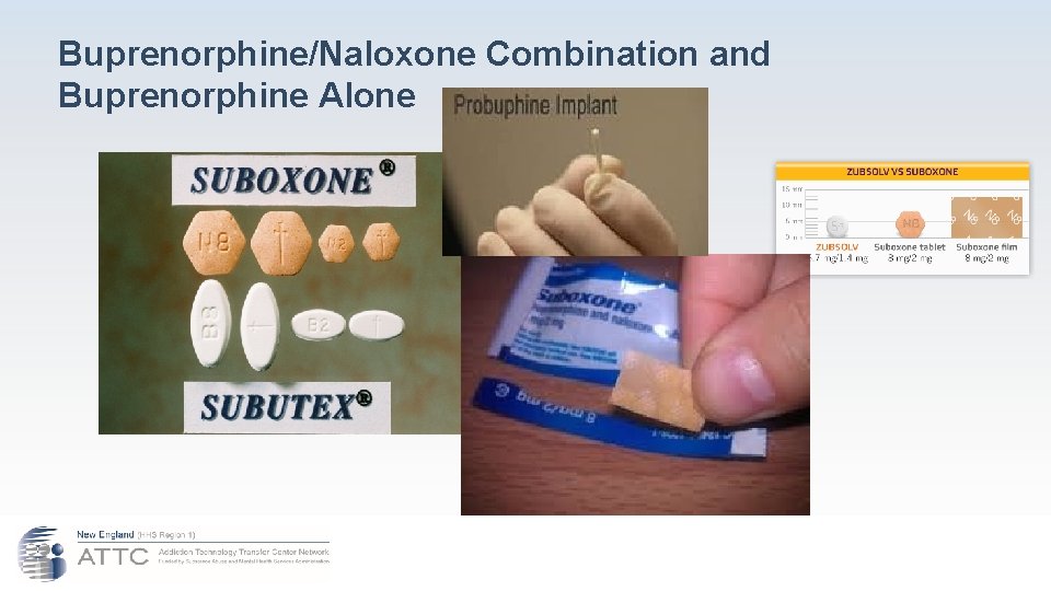 Buprenorphine/Naloxone Combination and Buprenorphine Alone 