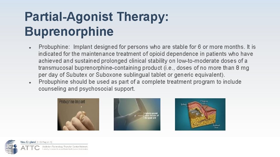 Partial-Agonist Therapy: Buprenorphine ● ● Probuphine: Implant designed for persons who are stable for