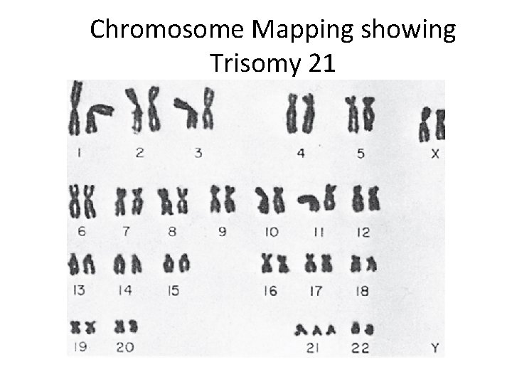 Chromosome Mapping showing Trisomy 21 