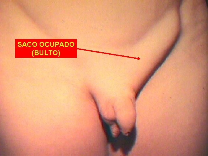 SACO OCUPADO (BULTO) 