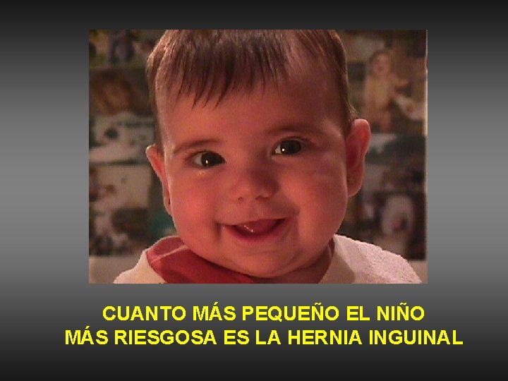 CUANTO MÁS PEQUEÑO EL NIÑO MÁS RIESGOSA ES LA HERNIA INGUINAL 