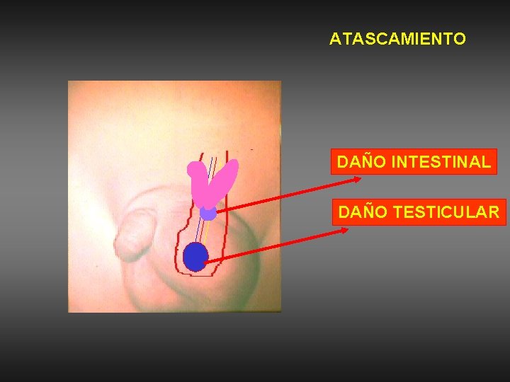 ATASCAMIENTO DAÑO INTESTINAL DAÑO TESTICULAR 