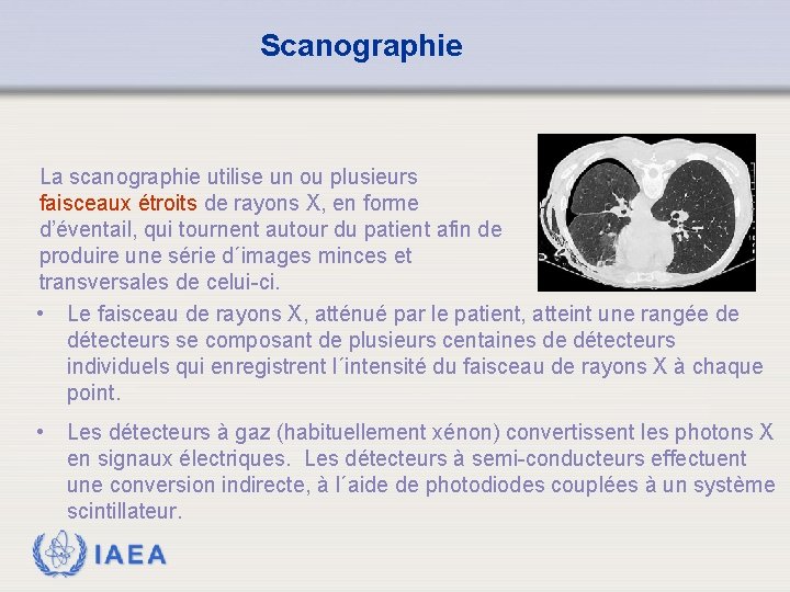 Scanographie La scanographie utilise un ou plusieurs faisceaux étroits de rayons X, en forme