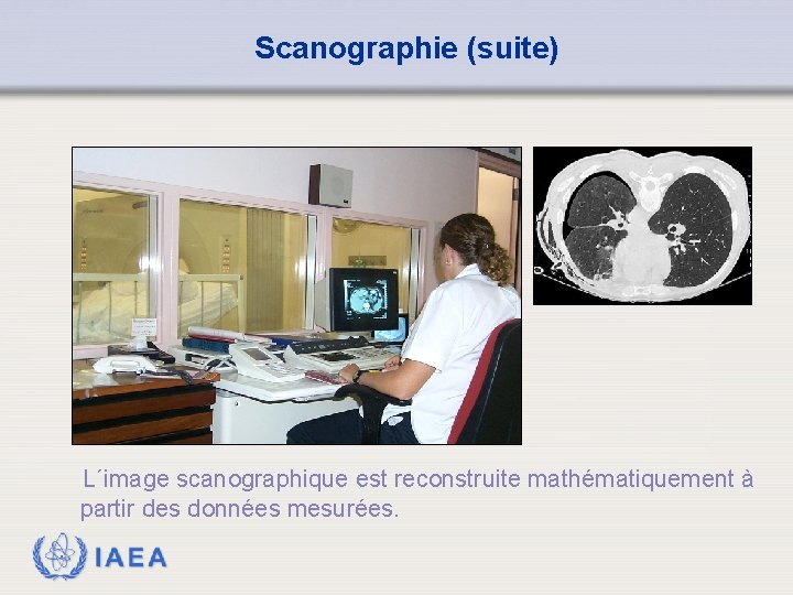 Scanographie (suite) L´image scanographique est reconstruite mathématiquement à partir des données mesurées. IAEA 