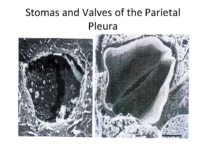 Stomas and Valves of the Parietal Pleura Stomas and Valves of the Parietal Pleura