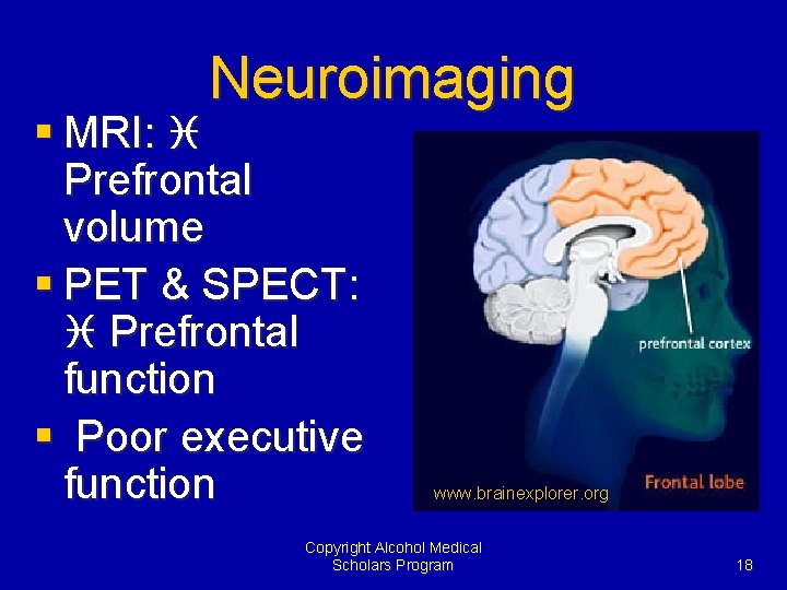 Neuroimaging § MRI: i Prefrontal volume § PET & SPECT: i Prefrontal function §