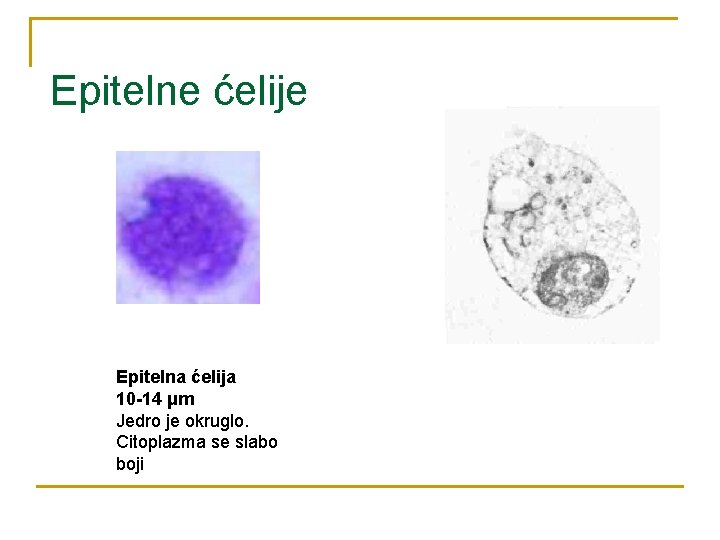 Epitelne ćelije Epitelna ćelija 10 -14 μm Jedro je okruglo. Citoplazma se slabo boji
