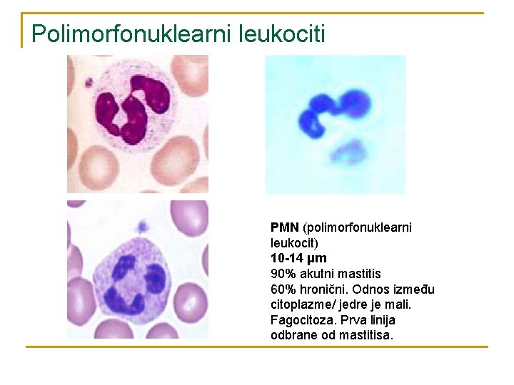 Polimorfonuklearni leukociti PMN (polimorfonuklearni leukocit) 10 -14 μm 90% akutni mastitis 60% hronični. Odnos