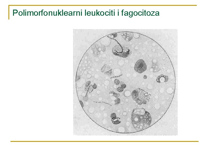 Polimorfonuklearni leukociti i fagocitoza 