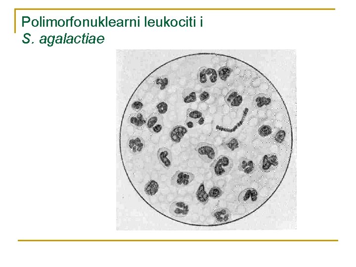 Polimorfonuklearni leukociti i S. agalactiae 