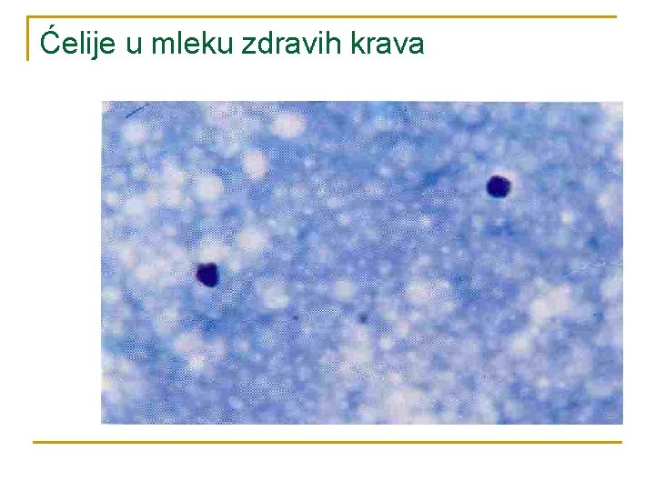 Ćelije u mleku zdravih krava 