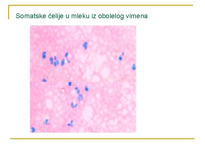 Somatske ćelije u mleku iz obolelog vimena 