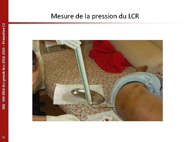 DIU VIH-SIDA des grands lacs 2018 -2019 – Promotion 12 Mesure de la pression