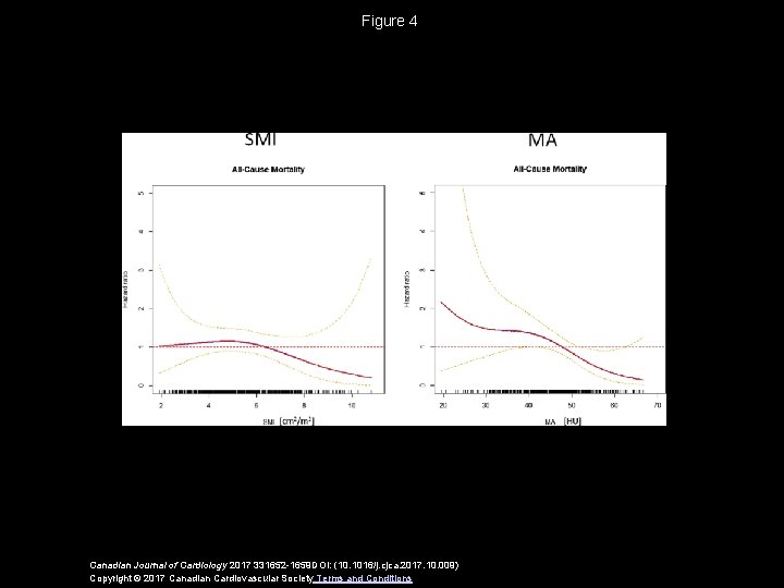 Figure 4 Canadian Journal of Cardiology 2017 331652 -1659 DOI: (10. 1016/j. cjca. 2017.