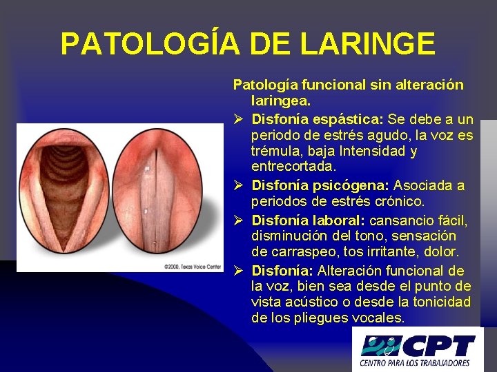 PATOLOGÍA DE LARINGE Patología funcional sin alteración laringea. Ø Disfonía espástica: Se debe a