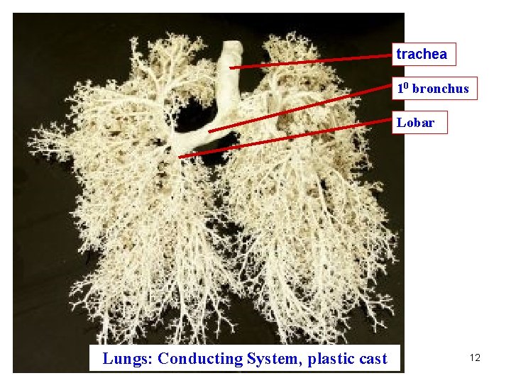 trachea 10 bronchus Lobar Lungs: Conducting System, plastic cast 12 