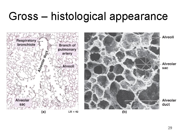 Gross – histological appearance 29 