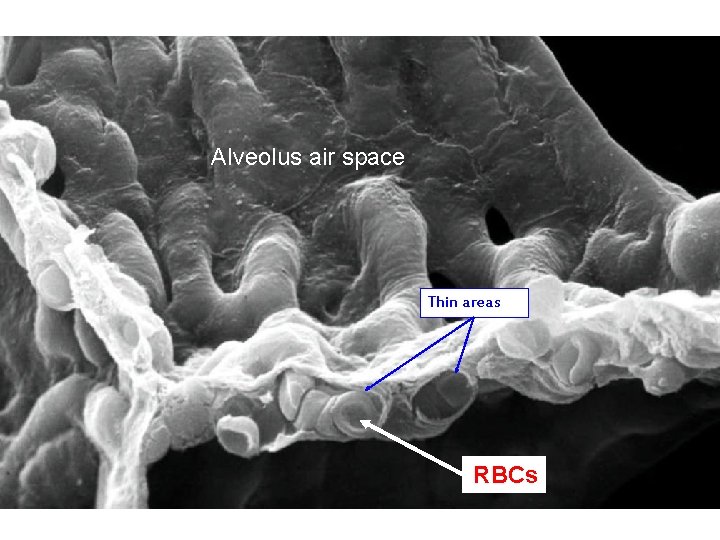 Alveolus air space Thin areas RBCs 36 