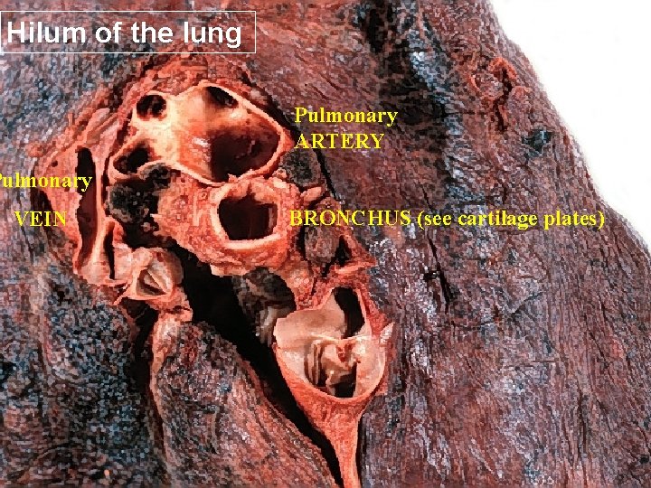 Hilum of the lung Pulmonary ARTERY Pulmonary VEIN BRONCHUS (see cartilage plates) 9 