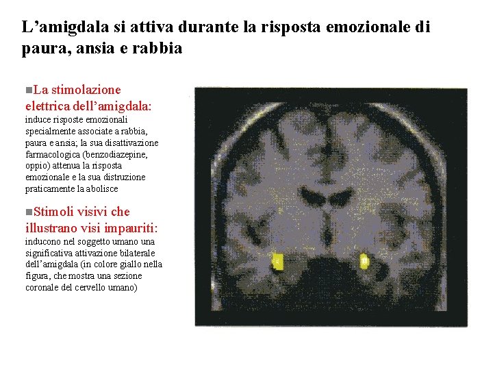 L’amigdala si attiva durante la risposta emozionale di paura, ansia e rabbia n. La L’amigdala si attiva durante la risposta emozionale di paura, ansia e rabbia n. La