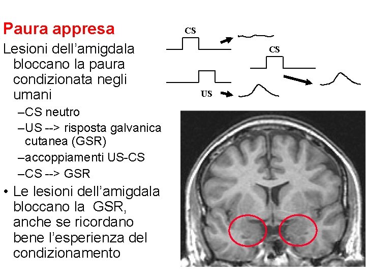 Paura appresa Lesioni dell’amigdala bloccano la paura condizionata negli umani – CS neutro – Paura appresa Lesioni dell’amigdala bloccano la paura condizionata negli umani – CS neutro –