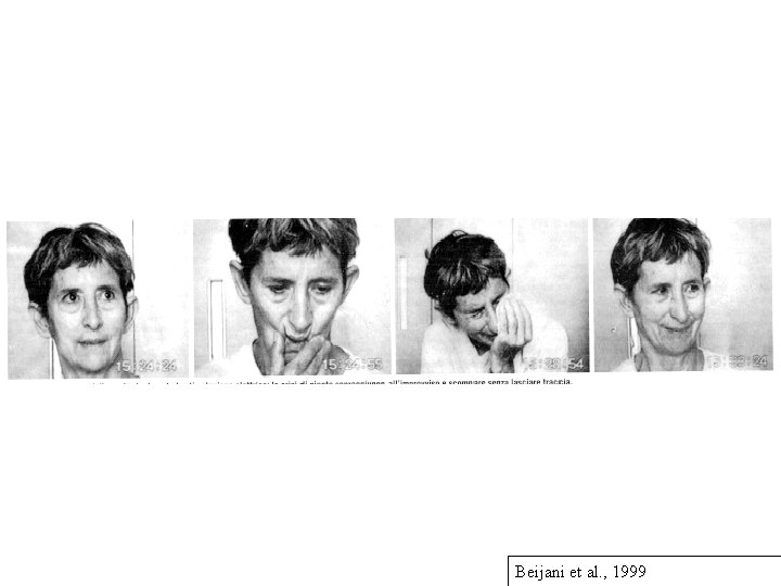 Beijani et al. , 1999 Beijani et al. , 1999
