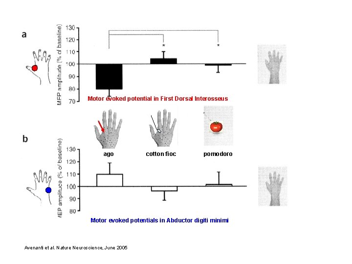 Motor evoked potential in First Dorsal Interosseus ago cotton fioc pomodoro Motor evoked potentials Motor evoked potential in First Dorsal Interosseus ago cotton fioc pomodoro Motor evoked potentials