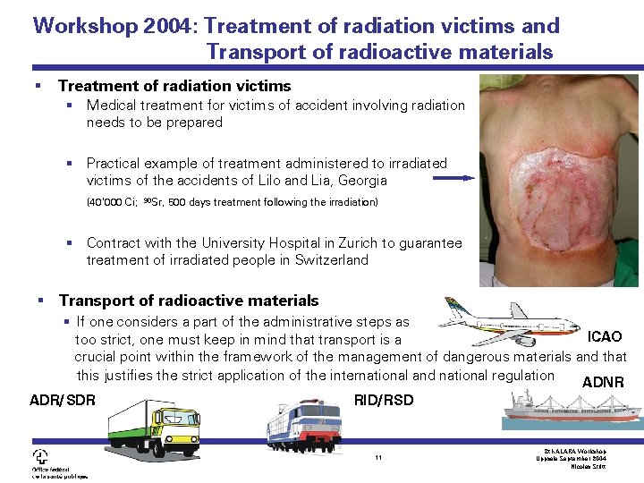 Workshop 2004: Treatment of radiation victims and Transport of radioactive materials § Treatment of