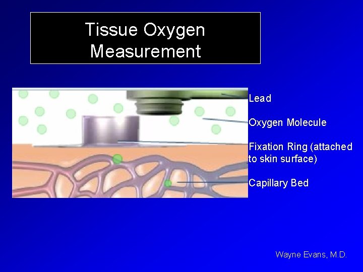 Tissue Oxygen Measurement Lead Oxygen Molecule Fixation Ring (attached to skin surface) Capillary Bed