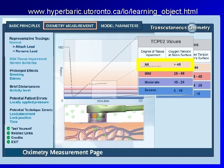 www. hyperbaric. utoronto. ca/lo/learning_object. html Wayne Evans, M. D. 