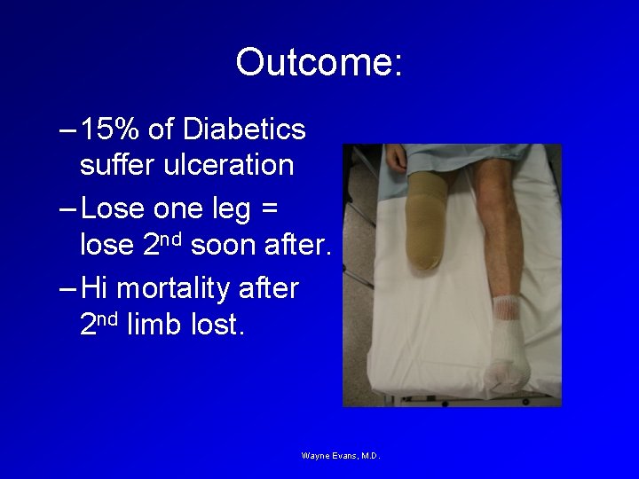 Outcome: – 15% of Diabetics suffer ulceration – Lose one leg = lose 2