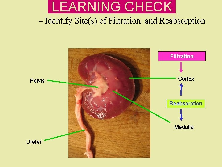 LEARNING CHECK – Identify Site(s) of Filtration and Reabsorption Filtration Pelvis Cortex Reabsorption Medulla LEARNING CHECK – Identify Site(s) of Filtration and Reabsorption Filtration Pelvis Cortex Reabsorption Medulla