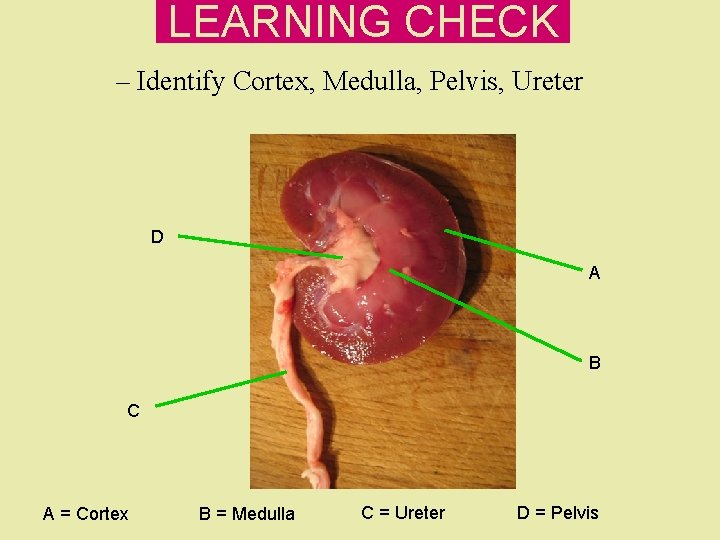 LEARNING CHECK – Identify Cortex, Medulla, Pelvis, Ureter D A B C A = LEARNING CHECK – Identify Cortex, Medulla, Pelvis, Ureter D A B C A =