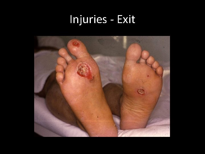 Injuries - Exit Injuries - Exit