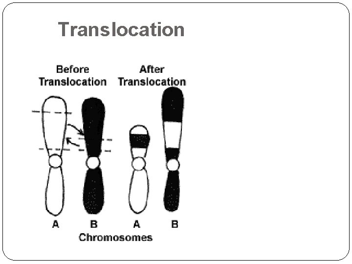 Translocation 21 