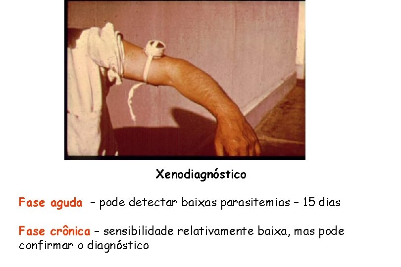 Xenodiagnóstico Fase aguda – pode detectar baixas parasitemias – 15 dias Fase crônica – Xenodiagnóstico Fase aguda – pode detectar baixas parasitemias – 15 dias Fase crônica –