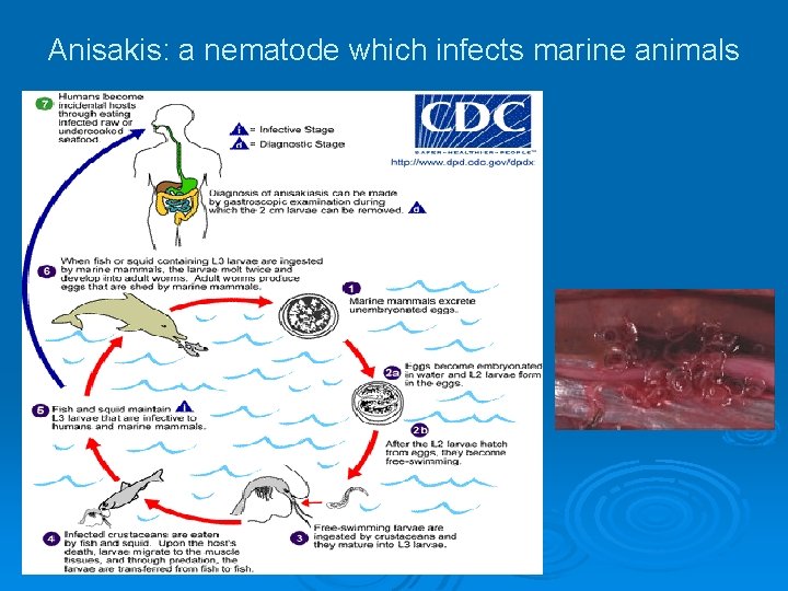 Anisakis: a nematode which infects marine animals 