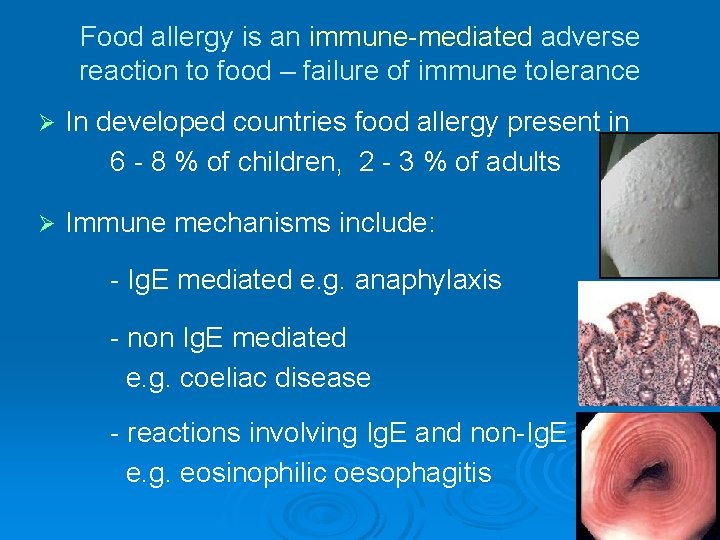 Food allergy is an immune-mediated adverse reaction to food – failure of immune tolerance