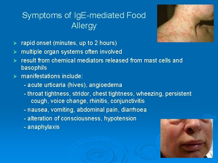 Symptoms of Ig. E-mediated Food Allergy rapid onset (minutes, up to 2 hours) Ø