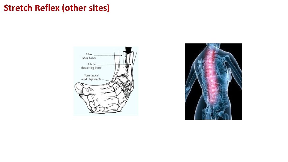 Stretch Reflex (other sites) 