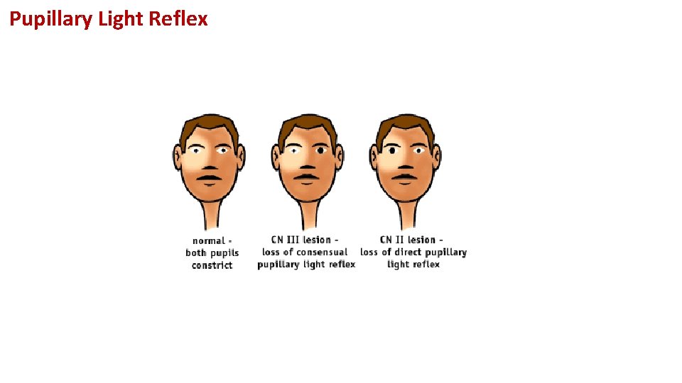 Pupillary Light Reflex 