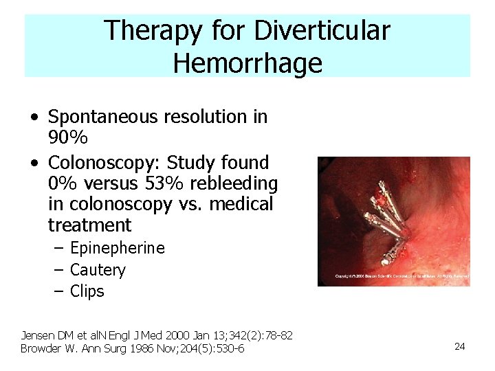 Therapy for Diverticular Hemorrhage • Spontaneous resolution in 90% • Colonoscopy: Study found 0%