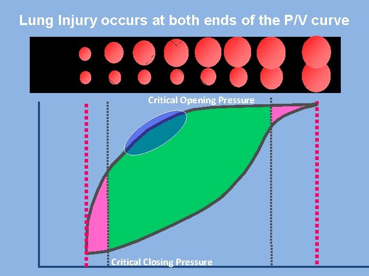 Lung Injury occurs at both ends of the P/V curve Critical Opening Pressure Critical