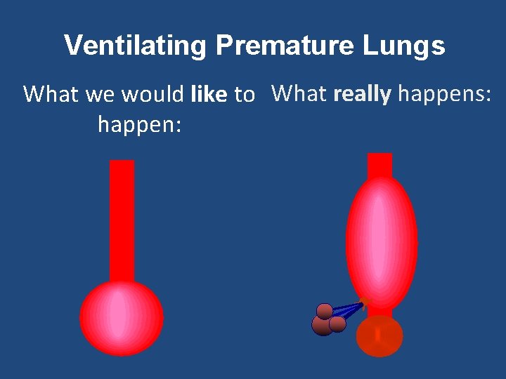 Ventilating Premature Lungs What we would like to What really happens: happen: 