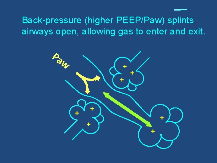 Back-pressure (higher PEEP/Paw) splints airways open, allowing gas to enter and exit. Pa w