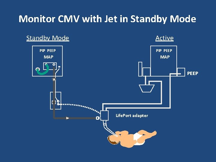 Monitor CMV with Jet in Standby Mode Active PIP PEEP MAP PEEP Life. Port