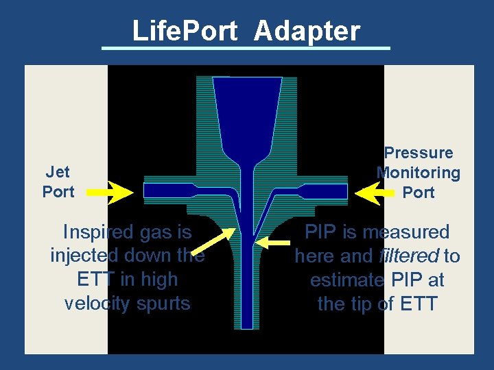 Life. Port Adapter Jet Port Inspired gas is injected down the ETT in high