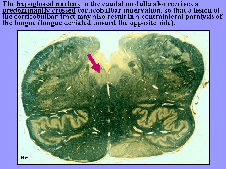 The hypoglossal nucleus in the caudal medulla also receives a predominantly crossed corticobulbar innervation,