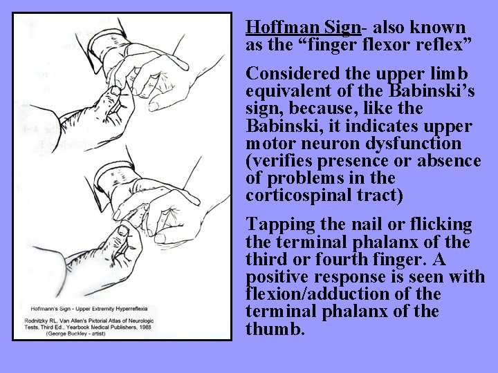 Hoffman Sign- also known as the “finger flexor reflex” Considered the upper limb equivalent