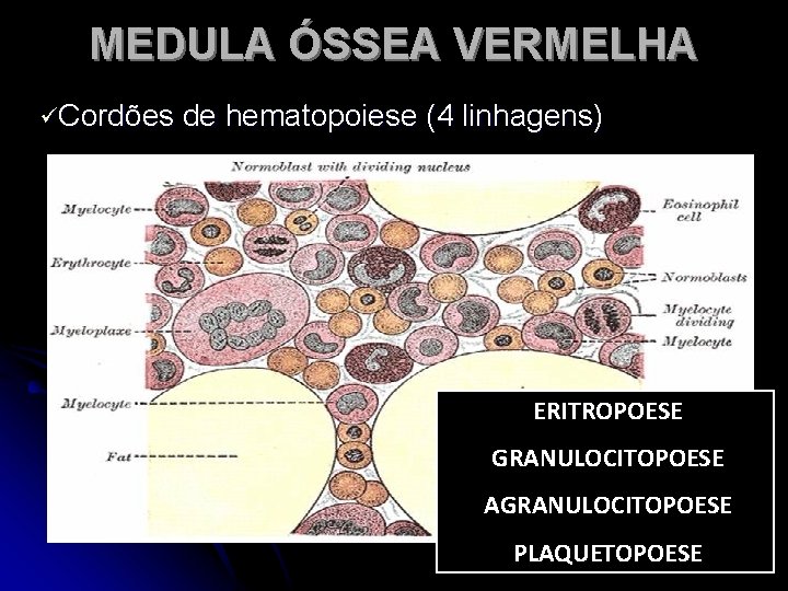 MEDULA ÓSSEA VERMELHA üCordões de hematopoiese (4 linhagens) ERITROPOESE GRANULOCITOPOESE AGRANULOCITOPOESE PLAQUETOPOESE 